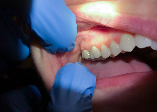 Best Mobile Emergency Dentist in Bingham Farms, MI