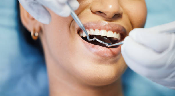 Best Emergency Root Canal Treatment in Bingham Farms, MI